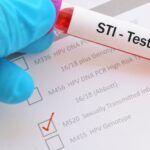 Where to Get Free or Lower-Cost STI Testing Near You