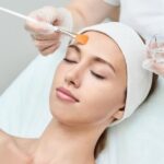 The Cosmetic Advantages of Getting a Chemical Peel Procedure