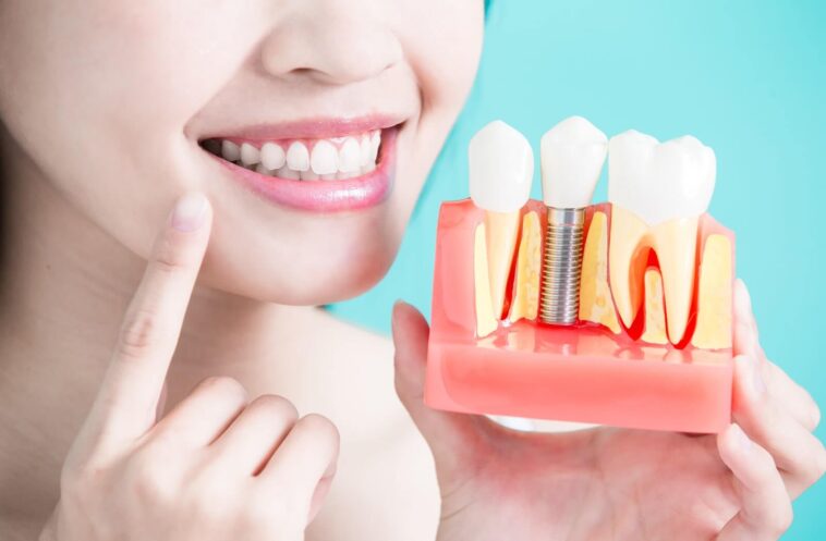 6 Reasons You Should Consider Dental Implants