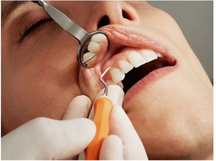 The Lifelong Rewards of Consistent Dental Cleanings